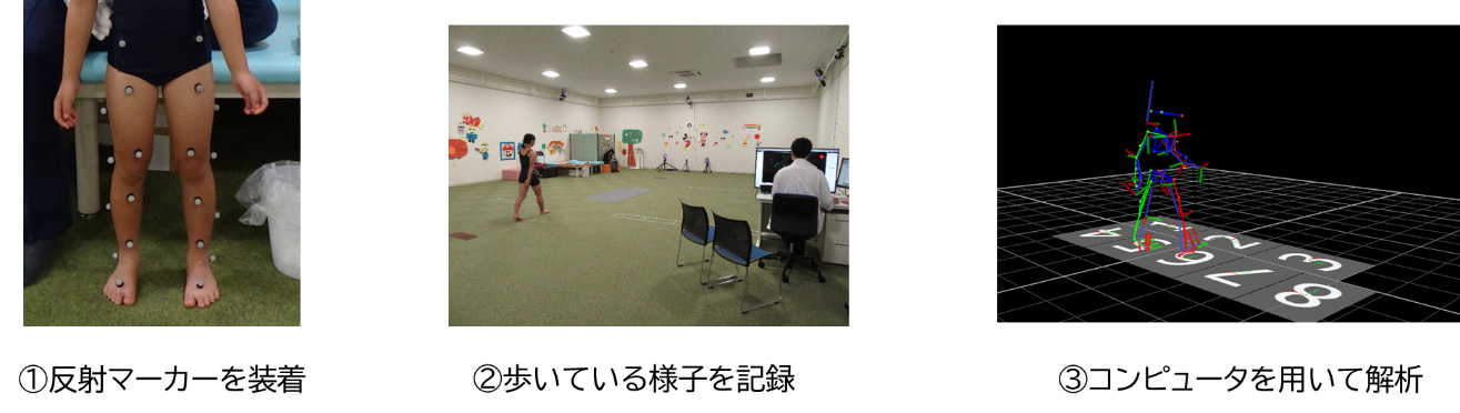 歩行分析の検査の流れ